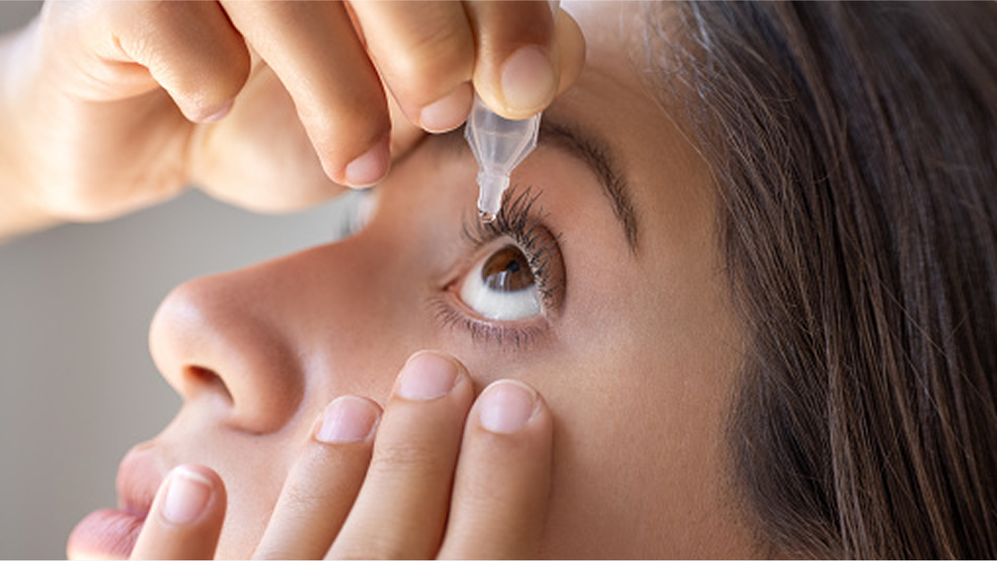 Imagen de una chica poniéndose una gota en el ojo